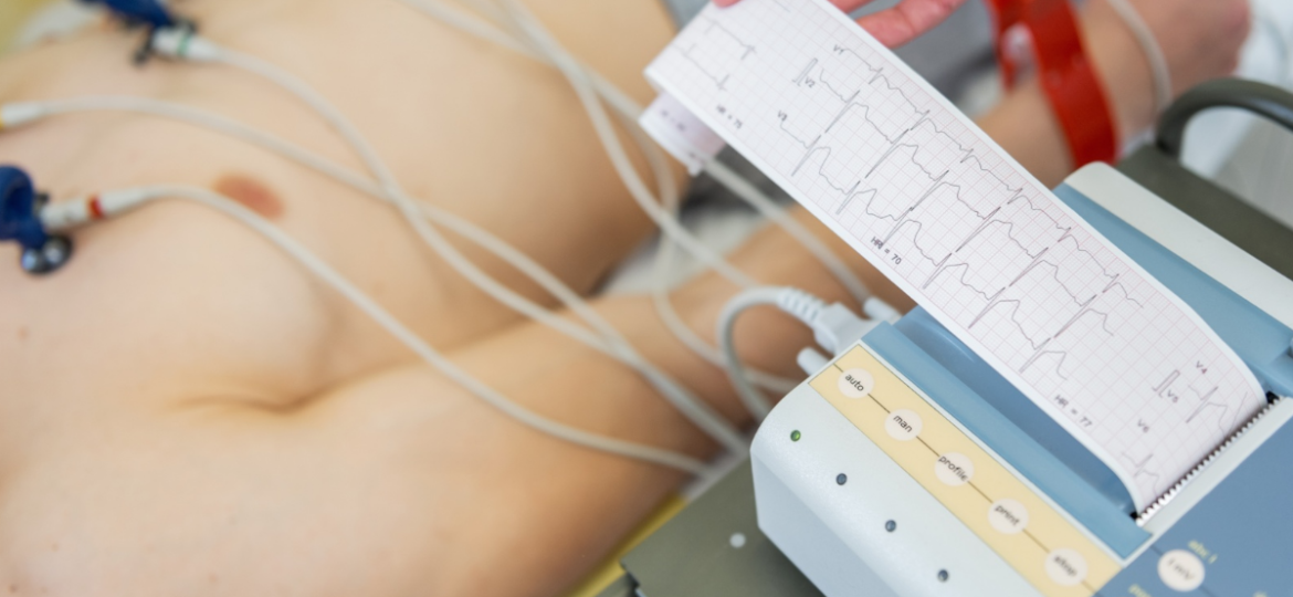 Kada se treba javiti lekaru zbog lupanja srca