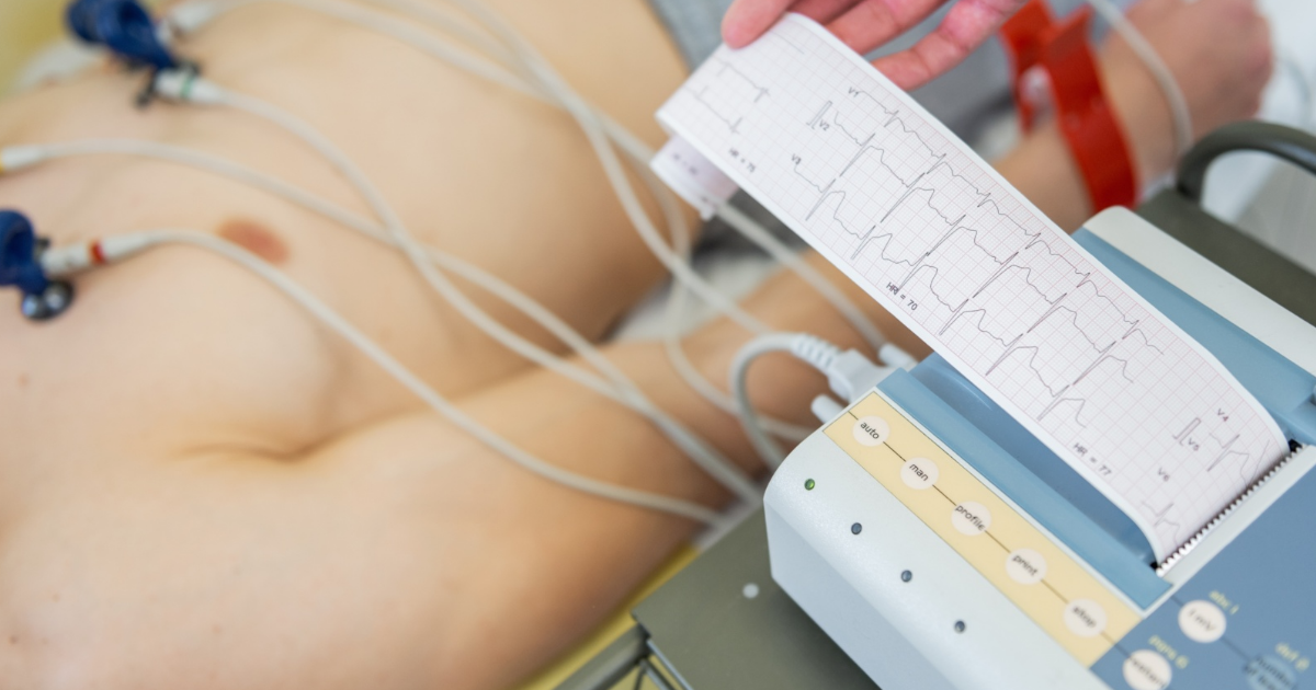 kada-se-javiti-lekaru-zbog-lupanja-srca