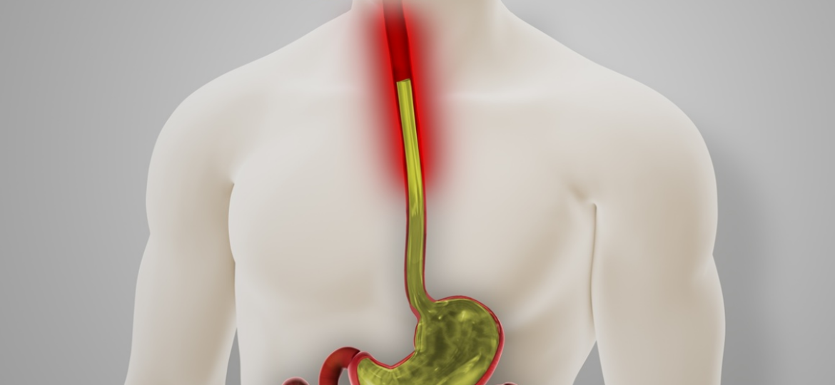 Zašto se javlja gorušica