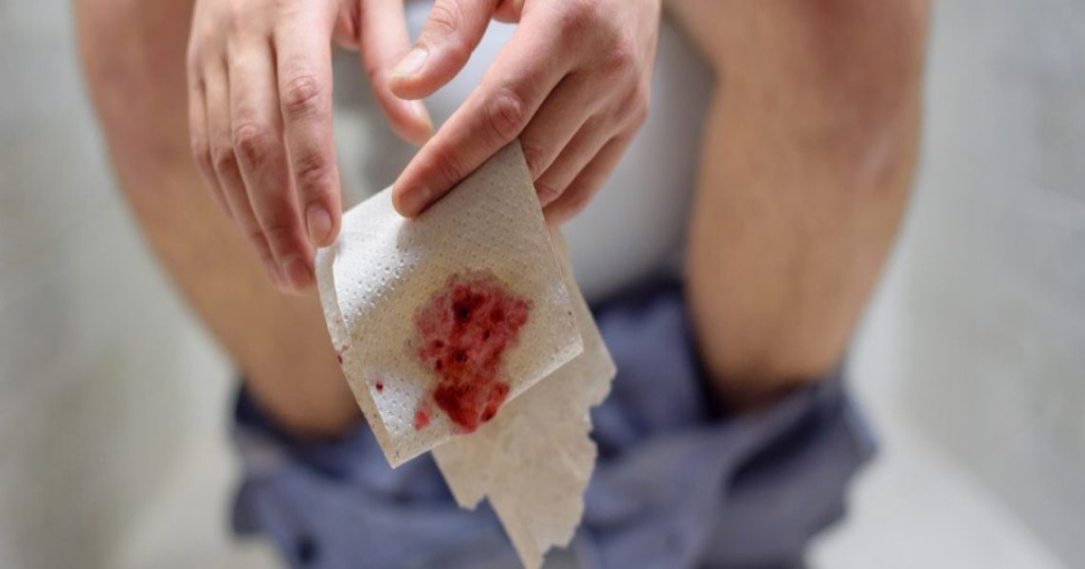 kada-se-javiti-lekaru-zbog-krvi-u-stolici