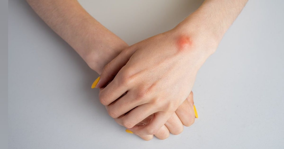 kada-se-javiti-lekaru-zbog-kvrzice-ili-promene-na-telu