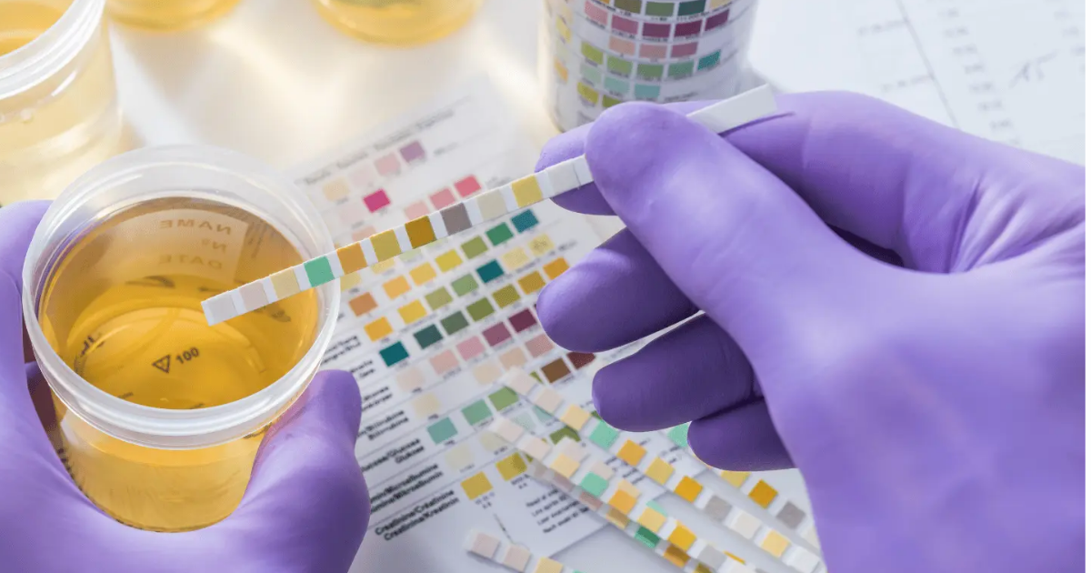 da-li-je-opasna-treca-grupa-sekreta-urina