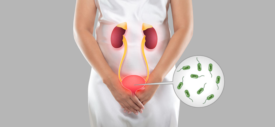 kada posetiti lekara zbog urinarne infekcije