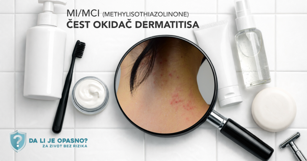 MI/MCI (methylisothiazolinone) u kozmetici – kako nastaje kontaktni dermatitis