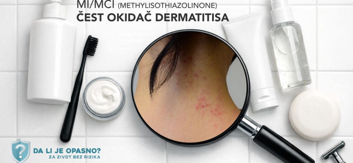 MI/MCI (methylisothiazolinone) u kozmetici – kako nastaje kontaktni dermatitis